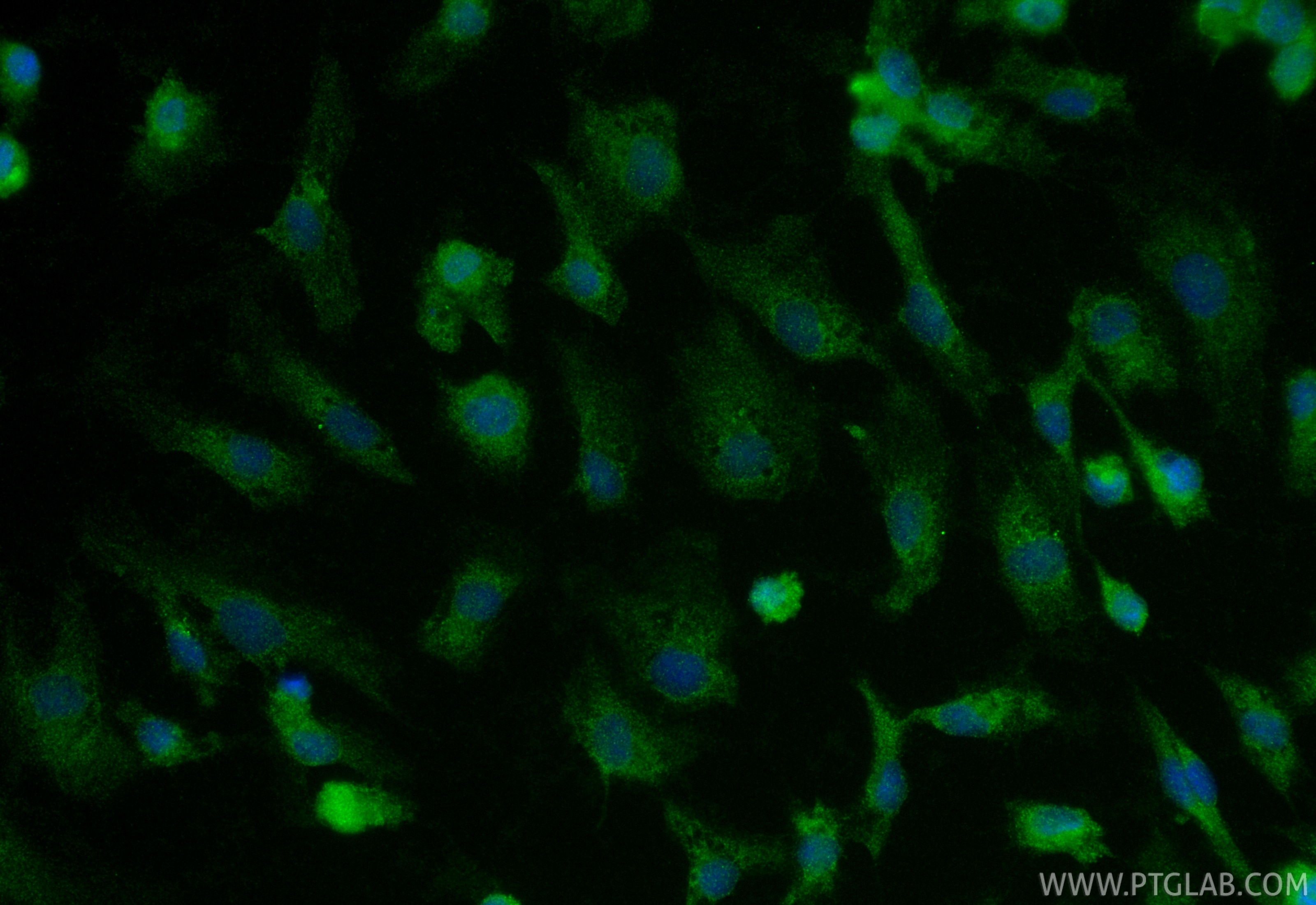 IF Staining of HUVEC using 21569-1-AP Immunofluorescence (IF) / fluorescent staining of HUVEC cells using NDST3 Polyclonal antibody (21569-1-AP)