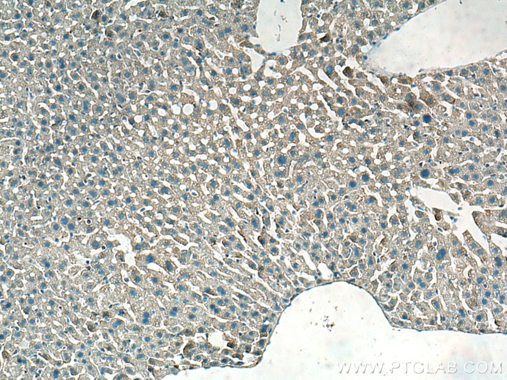 Immunohistochemistry (IHC) staining of mouse liver tissue using NDUFA1 Polyclonal antibody (15561-1-AP)