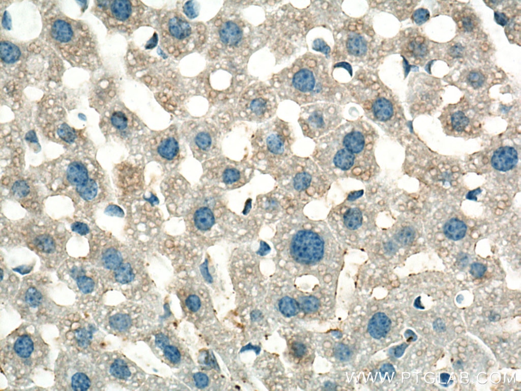 Immunohistochemistry (IHC) staining of mouse liver tissue using NDUFA1 Polyclonal antibody (15561-1-AP)