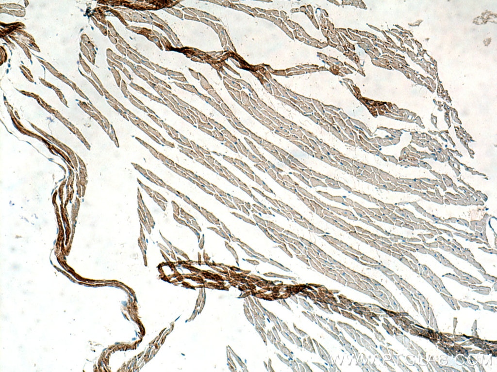 Immunohistochemistry (IHC) staining of mouse heart tissue using NDUFA1 Polyclonal antibody (15561-1-AP)