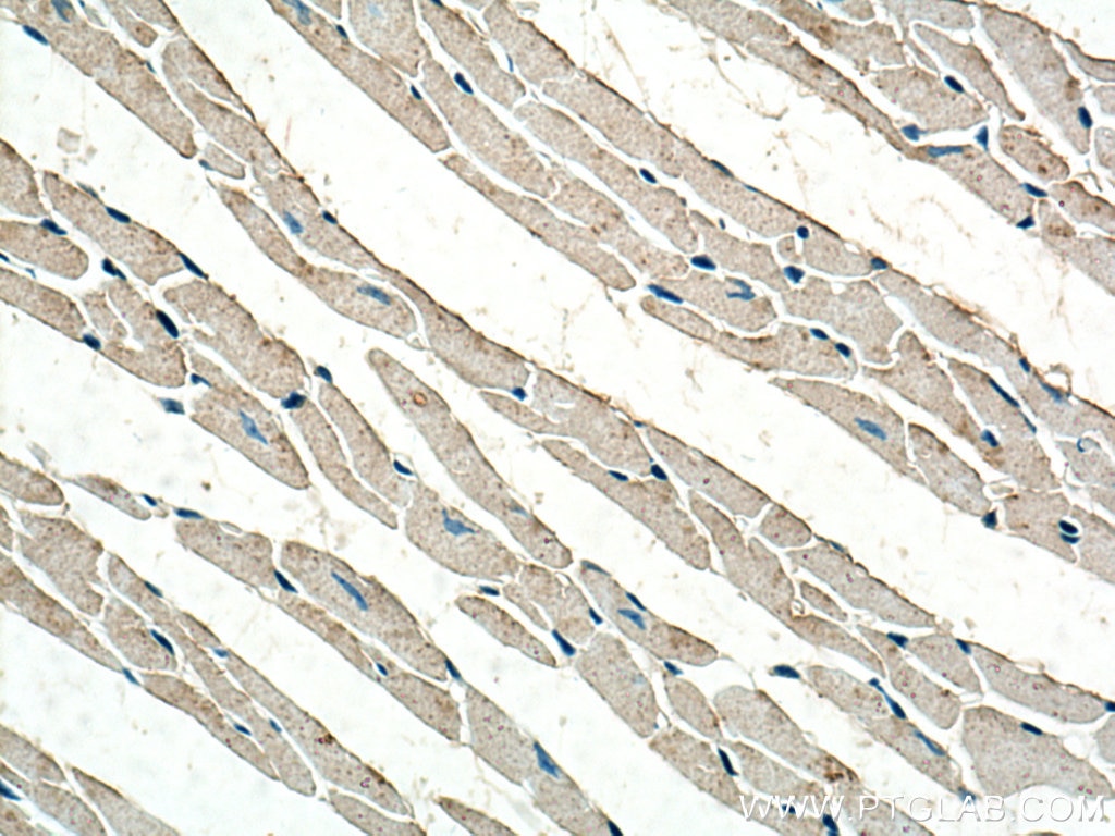 Immunohistochemistry (IHC) staining of mouse heart tissue using NDUFA1 Polyclonal antibody (15561-1-AP)