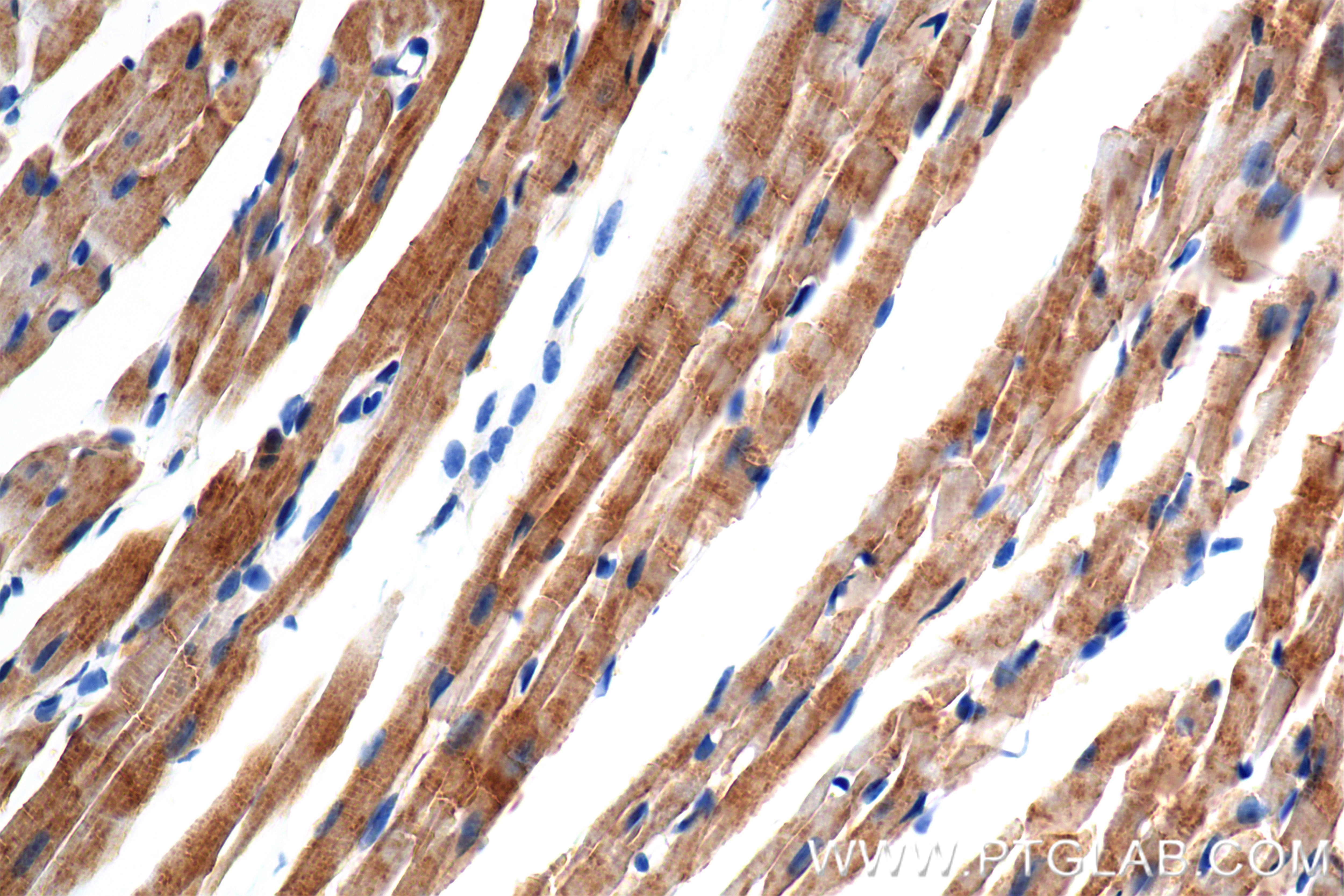Immunohistochemical analysis of paraffin-embedded mouse heart tissue slide using 86470-1-RR (NDUFA1 antibody) at dilution of 1:1000 (under 40x lens). Heat mediated antigen retrieval with Tris-EDTA buffer (pH 9.0). Immunohistochemistry (IHC) staining of mouse heart tissue using NDUFA1 Recombinant antibody (86470-1-RR)