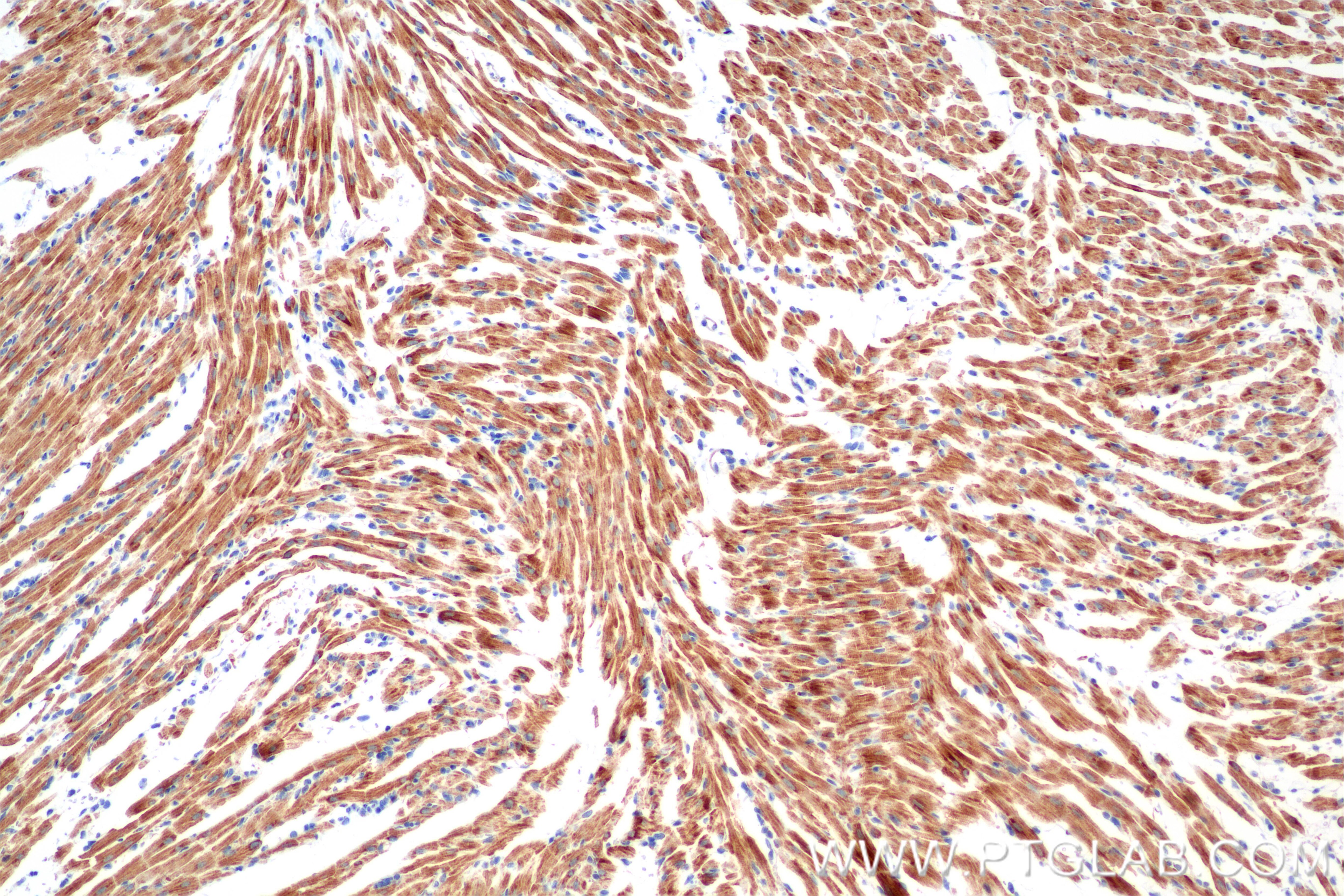 Immunohistochemical analysis of paraffin-embedded rat heart tissue slide using 86470-1-RR (NDUFA1 antibody) at dilution of 1:1000 (under 10x lens). Heat mediated antigen retrieval with Tris-EDTA buffer (pH 9.0). Immunohistochemistry (IHC) staining of rat heart tissue using NDUFA1 Recombinant antibody (86470-1-RR)