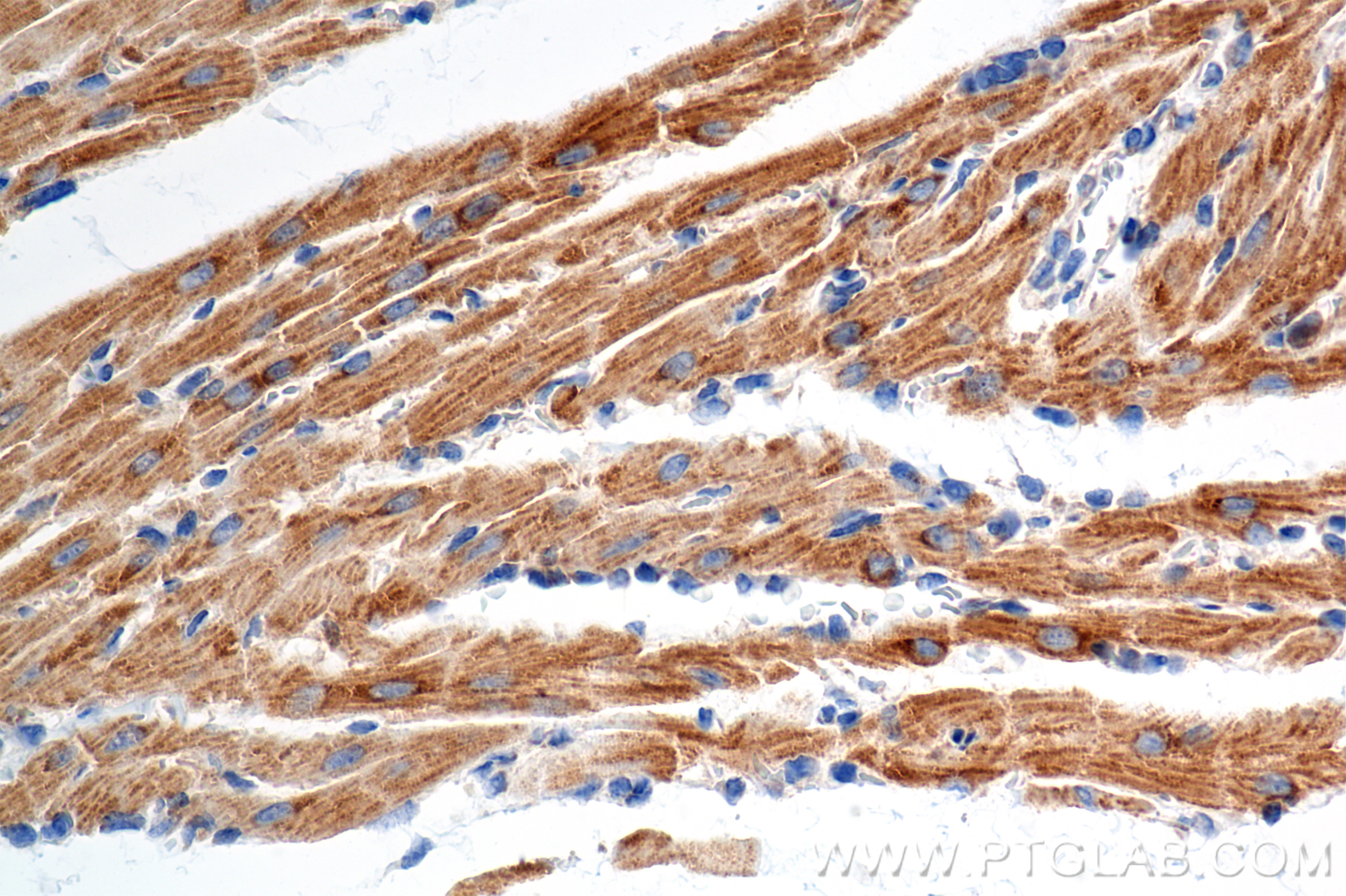Immunohistochemical analysis of paraffin-embedded rat heart tissue slide using 86470-1-RR (NDUFA1 antibody) at dilution of 1:1000 (under 40x lens). Heat mediated antigen retrieval with Tris-EDTA buffer (pH 9.0). Immunohistochemistry (IHC) staining of rat heart tissue using NDUFA1 Recombinant antibody (86470-1-RR)