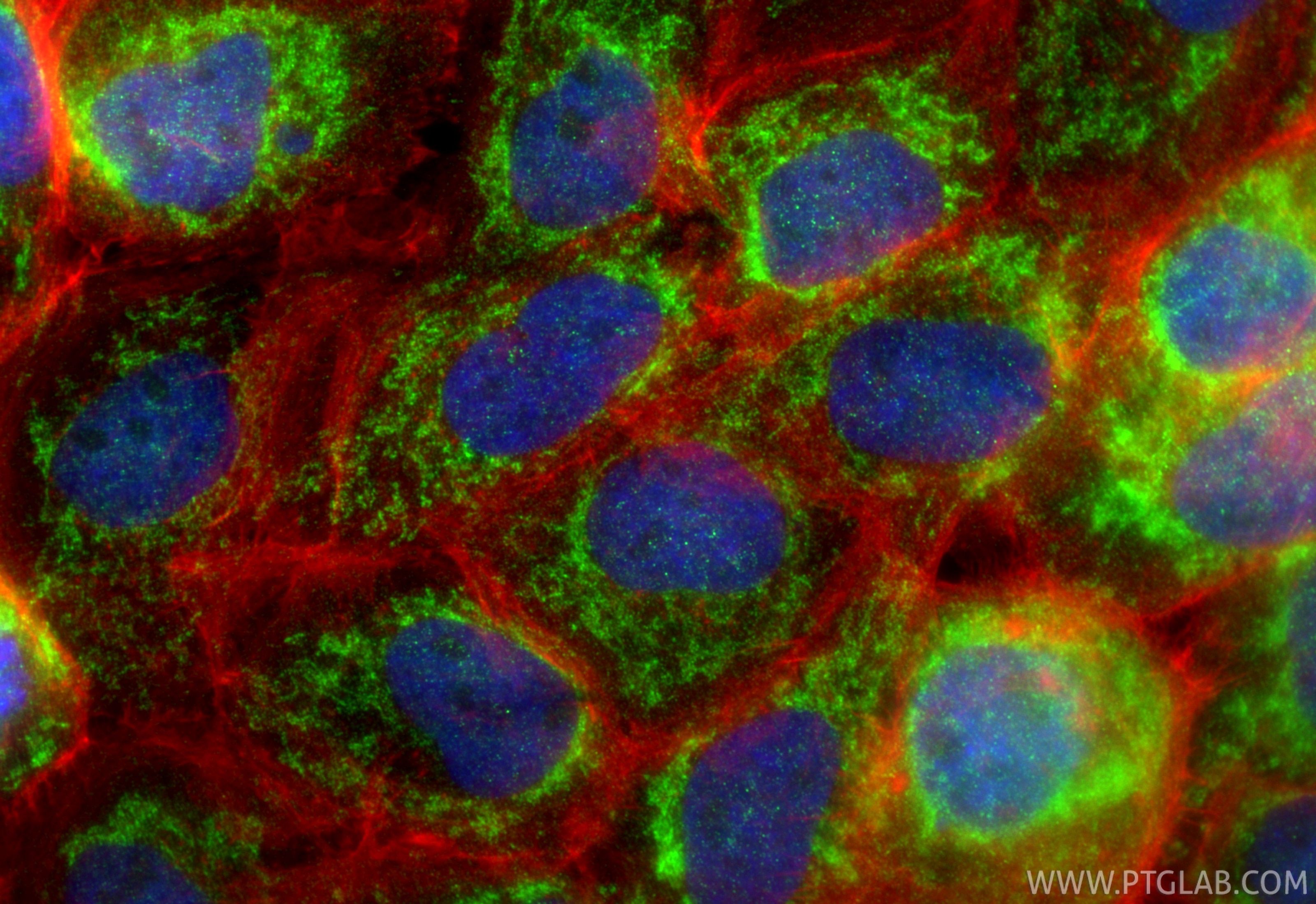 IF Staining of A431 using 32947-1-AP Immunofluorescence (IF) / fluorescent staining of A431 cells using NDUFA10 Polyclonal antibody (32947-1-AP)