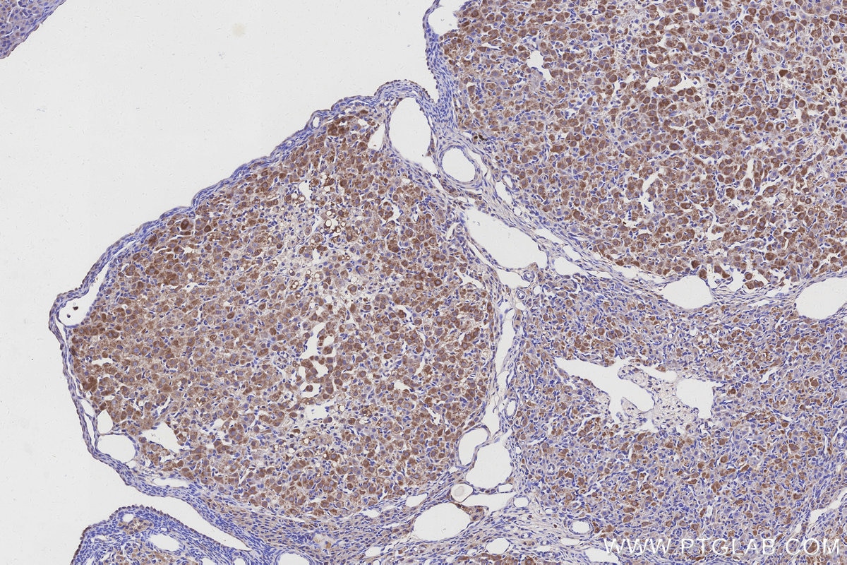 IHC staining of rat ovary using 32947-1-AP Immunohistochemistry (IHC) staining of rat ovary tissue using NDUFA10 Polyclonal antibody (32947-1-AP)