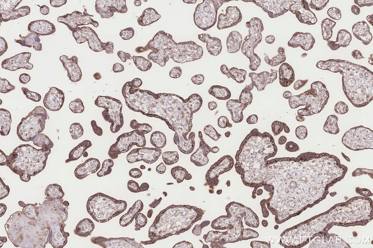 Immunohistochemistry (IHC) staining of human placenta tissue using NDUFA11 Polyclonal antibody (17879-1-AP)