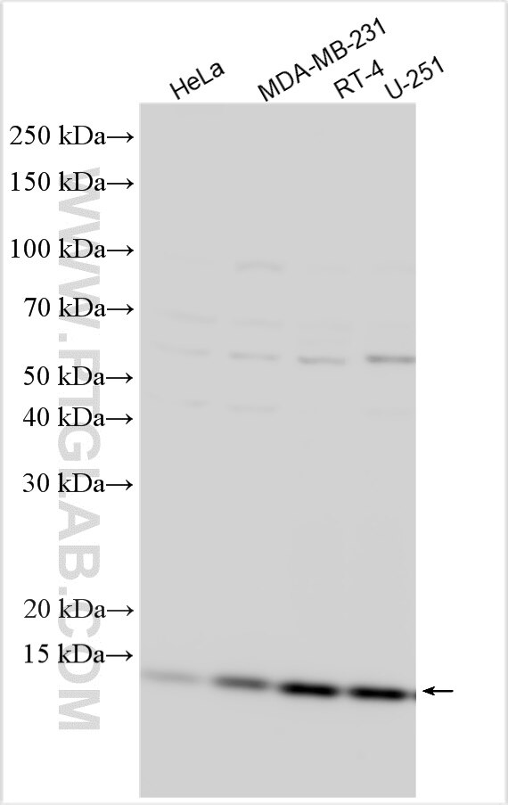 Western Blot (WB) analysis of various lysates using NDUFA11 Polyclonal antibody (17879-1-AP)