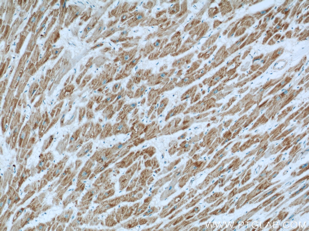 Immunohistochemistry (IHC) staining of human heart tissue using GRIM19 Polyclonal antibody (10986-1-AP)