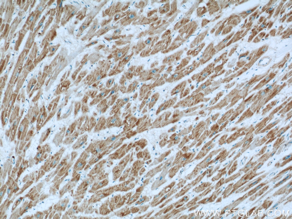Immunohistochemistry (IHC) staining of human heart tissue using GRIM19 Polyclonal antibody (10986-1-AP)