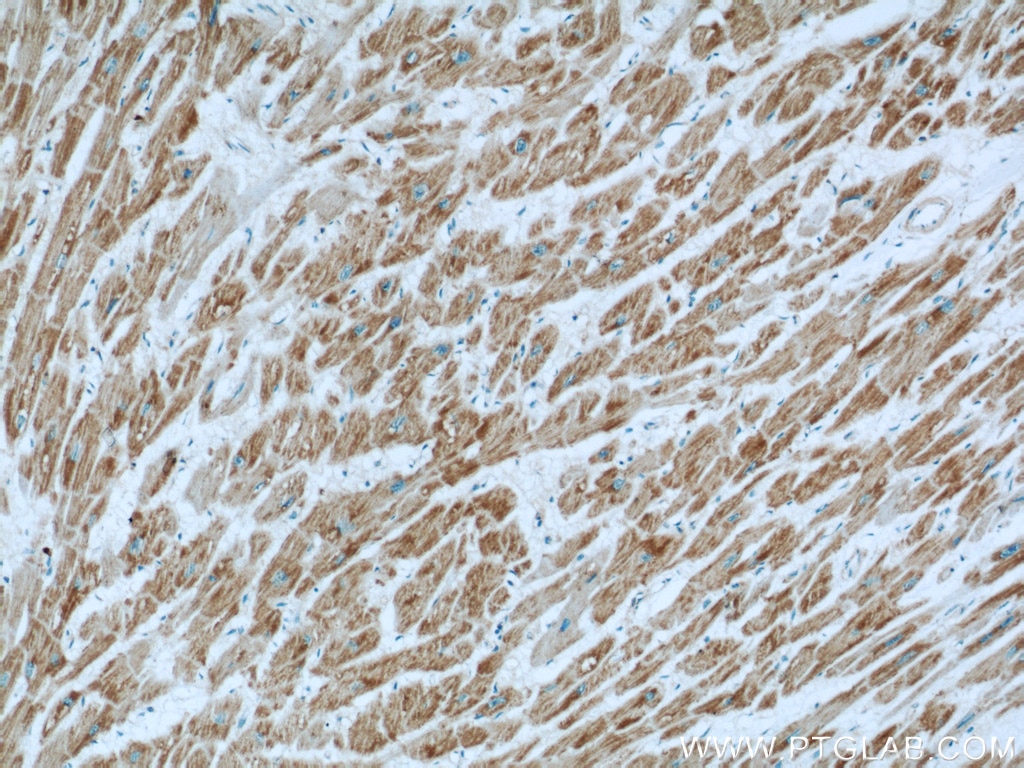 IHC staining of human heart using 10986-1-AP