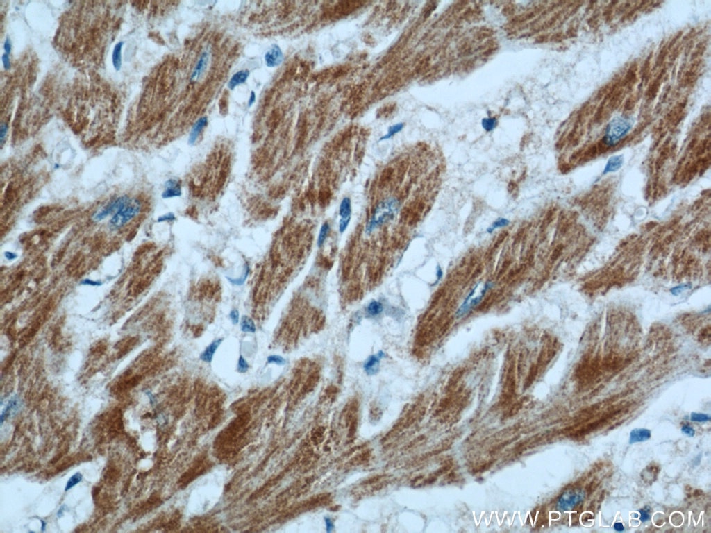 Immunohistochemistry (IHC) staining of human heart tissue using GRIM19 Polyclonal antibody (10986-1-AP)