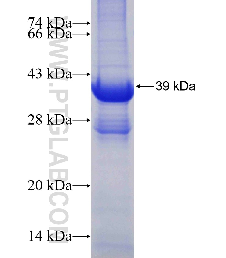 GRIM19 fusion protein Ag1435 SDS-PAGE