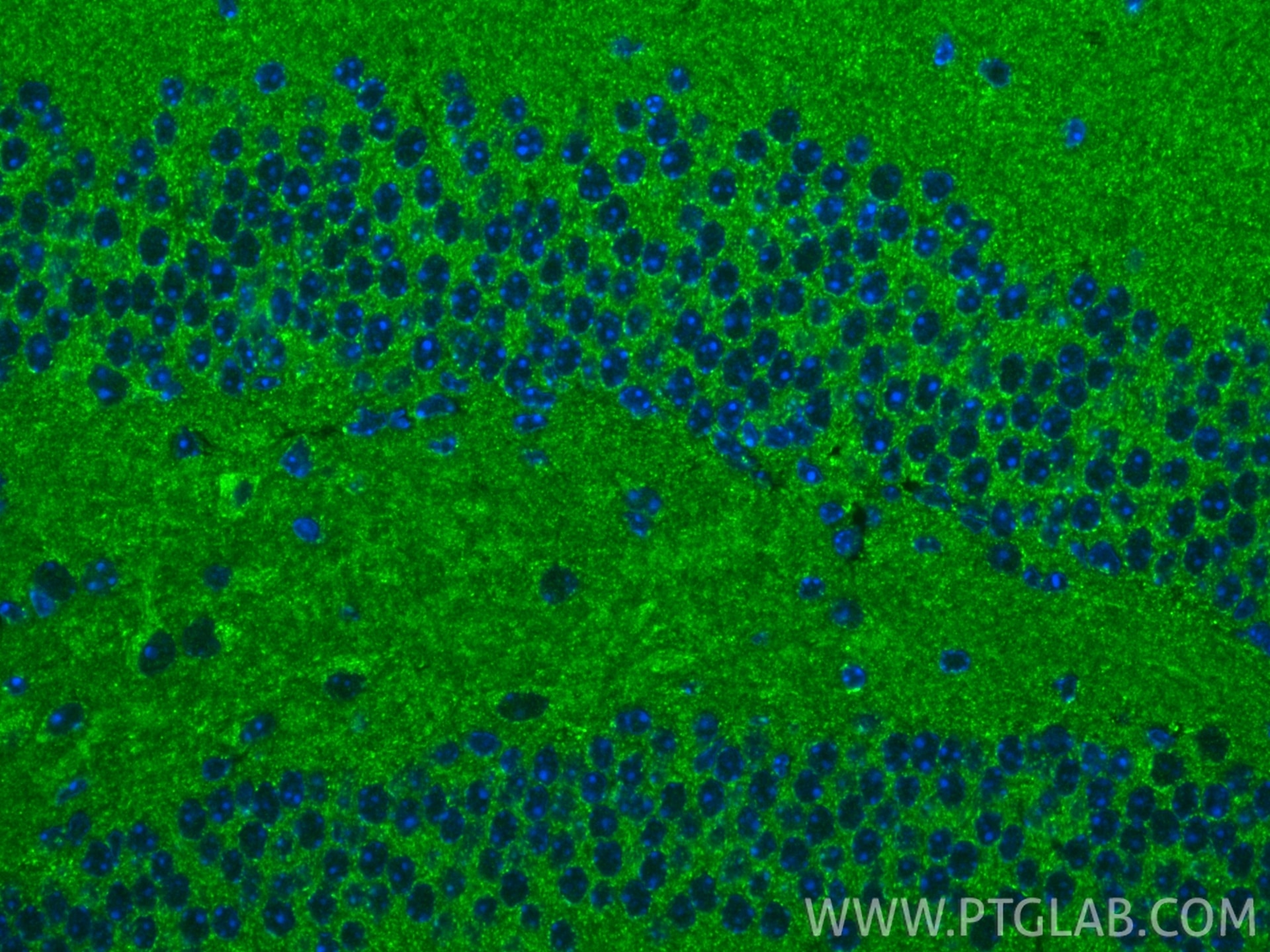 Immunofluorescence (IF) / fluorescent staining of mouse brain tissue using NDUFA2 Polyclonal antibody (15889-1-AP)