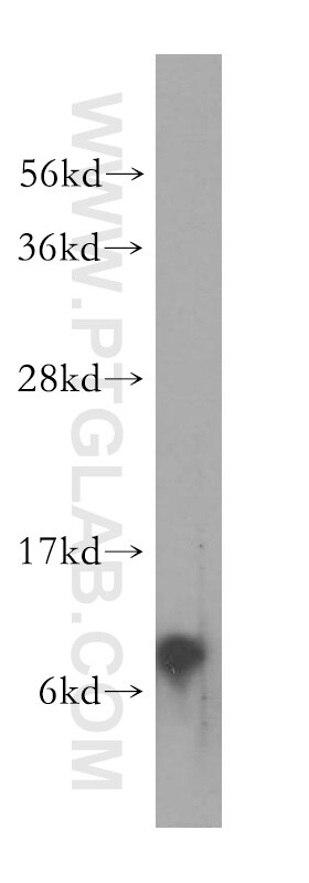 Western Blot (WB) analysis of human brain tissue using NDUFA3 Polyclonal antibody (17257-1-AP)