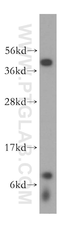 Western Blot (WB) analysis of HeLa cells using NDUFA3 Polyclonal antibody (17257-1-AP)