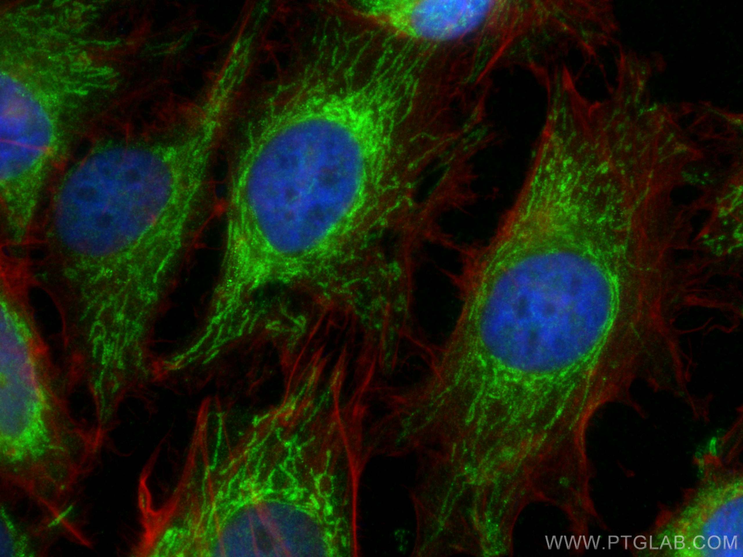 Immunofluorescence (IF) / fluorescent staining of HeLa cells using NDUFA4L2 Polyclonal antibody (16480-1-AP)