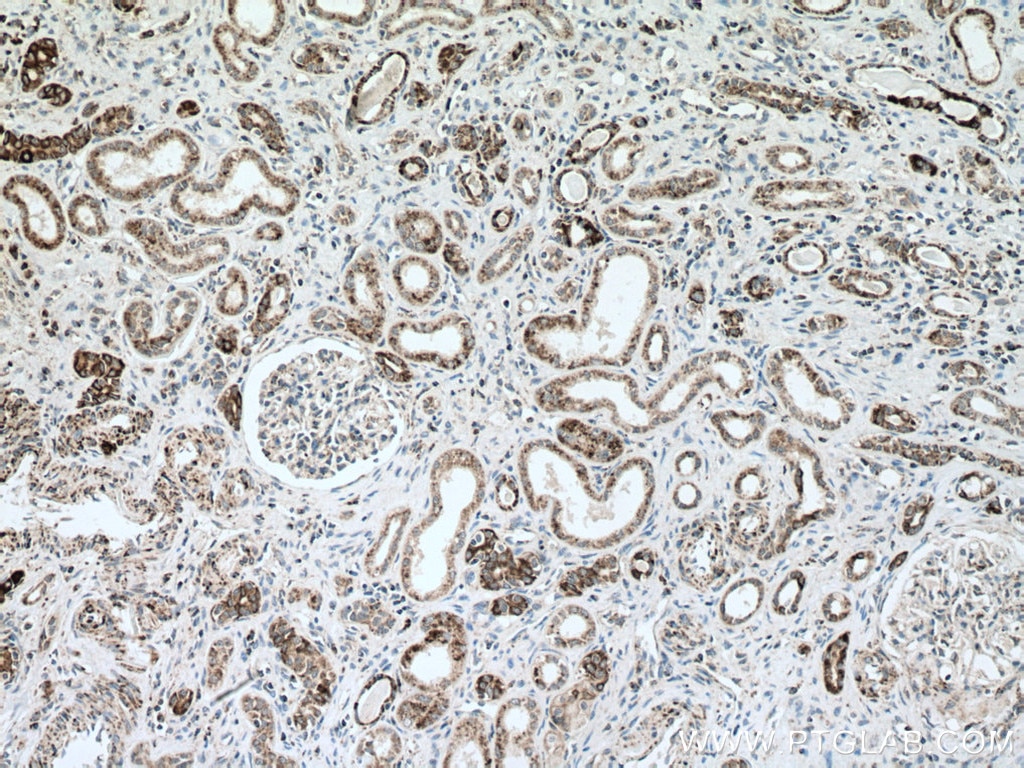 Immunohistochemistry (IHC) staining of human kidney tissue using NDUFA4L2 Polyclonal antibody (16480-1-AP)