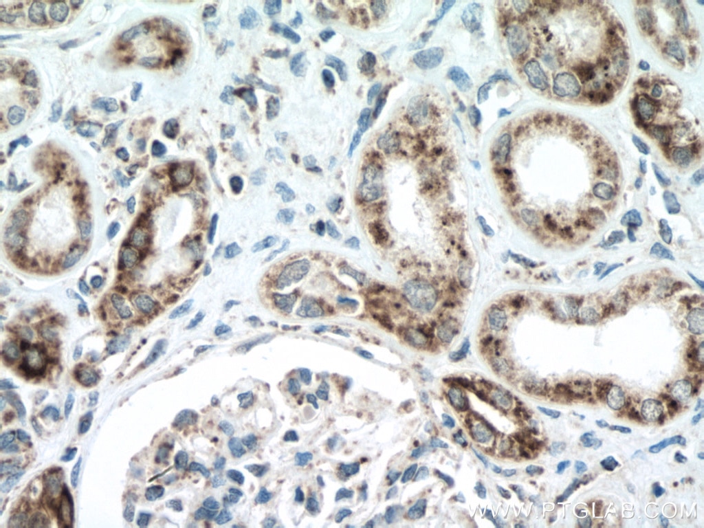 Immunohistochemistry (IHC) staining of human kidney tissue using NDUFA4L2 Polyclonal antibody (16480-1-AP)