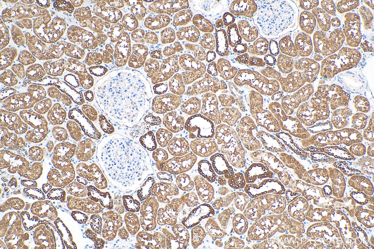 IHC staining of human kidney using 16480-1-AP