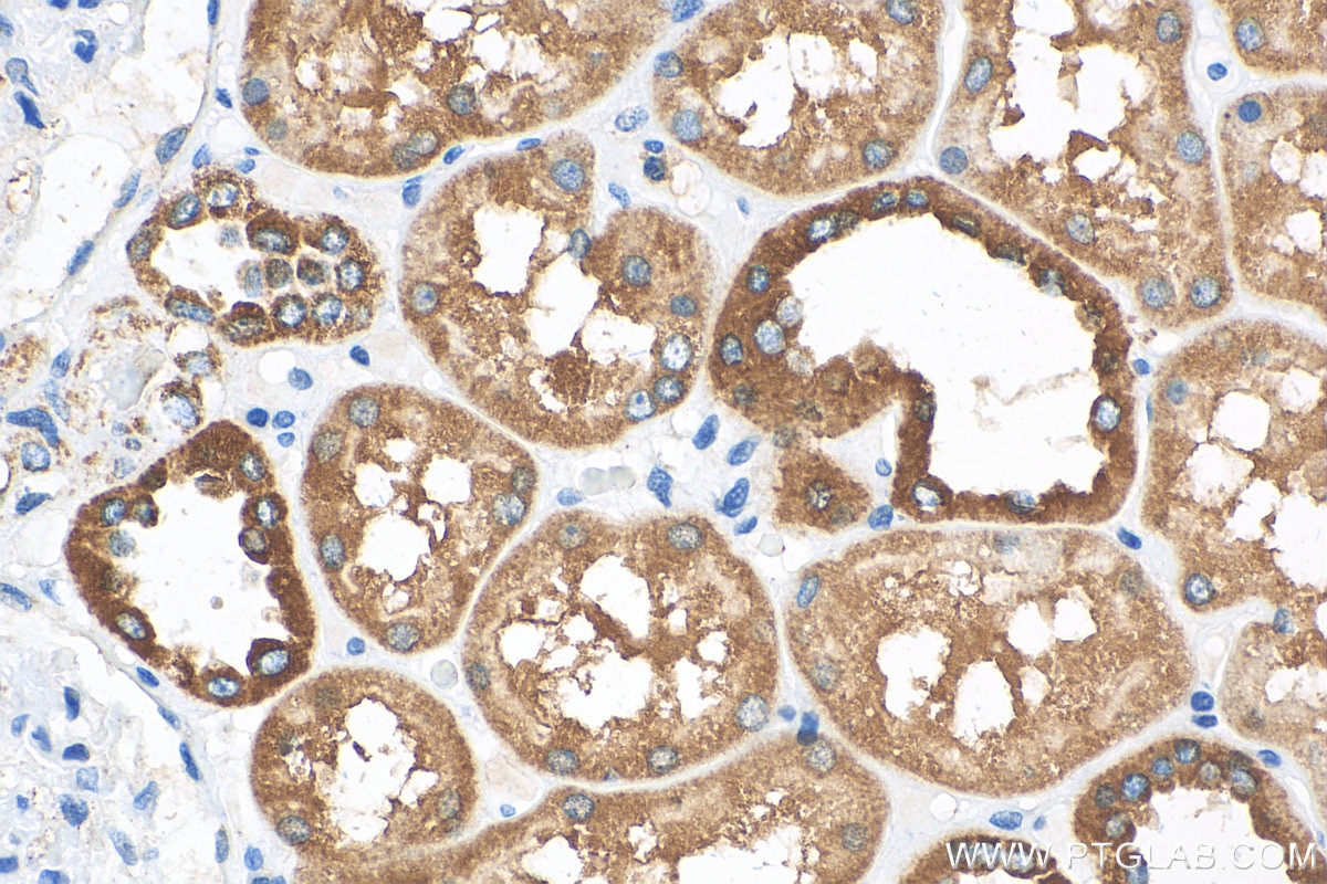 Immunohistochemistry (IHC) staining of human kidney tissue using NDUFA4L2 Polyclonal antibody (16480-1-AP)