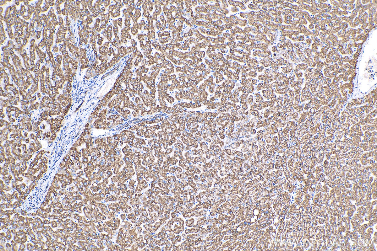 IHC staining of human liver using 16480-1-AP