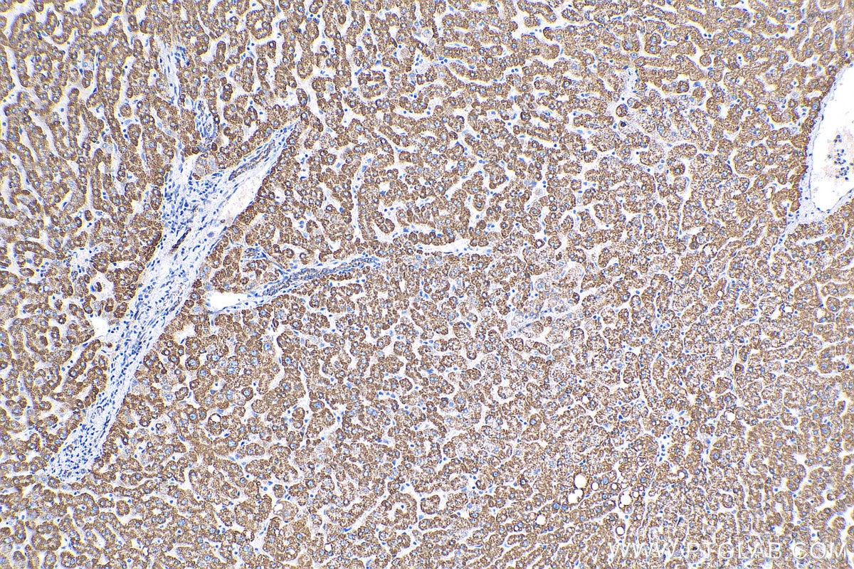 Immunohistochemistry (IHC) staining of human liver tissue using NDUFA4L2 Polyclonal antibody (16480-1-AP)