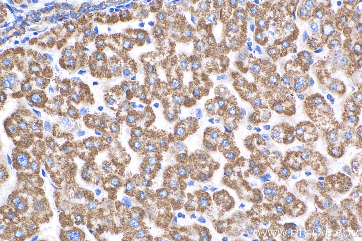 Immunohistochemistry (IHC) staining of human liver tissue using NDUFA4L2 Polyclonal antibody (16480-1-AP)