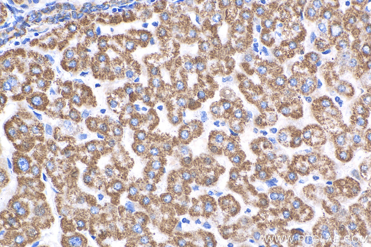 IHC staining of human liver using 16480-1-AP