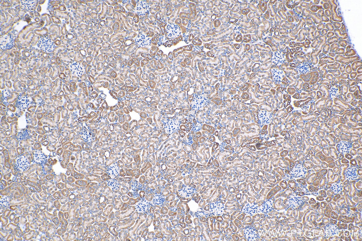 IHC staining of mouse kidney using 16480-1-AP