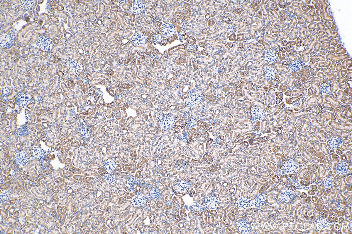 Immunohistochemistry (IHC) staining of mouse kidney tissue using NDUFA4L2 Polyclonal antibody (16480-1-AP)