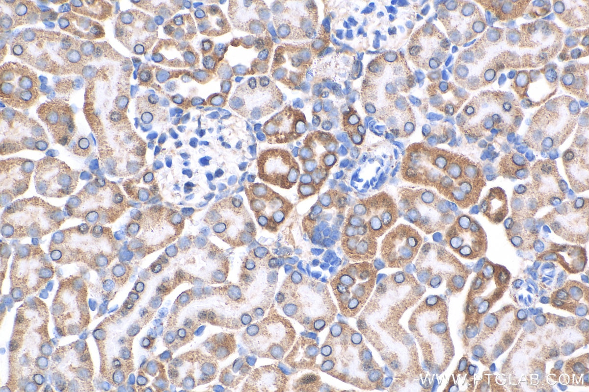 Immunohistochemistry (IHC) staining of mouse kidney tissue using NDUFA4L2 Polyclonal antibody (16480-1-AP)