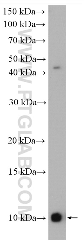 Western Blot (WB) analysis of HeLa cells using NDUFA4L2 Polyclonal antibody (16480-1-AP)