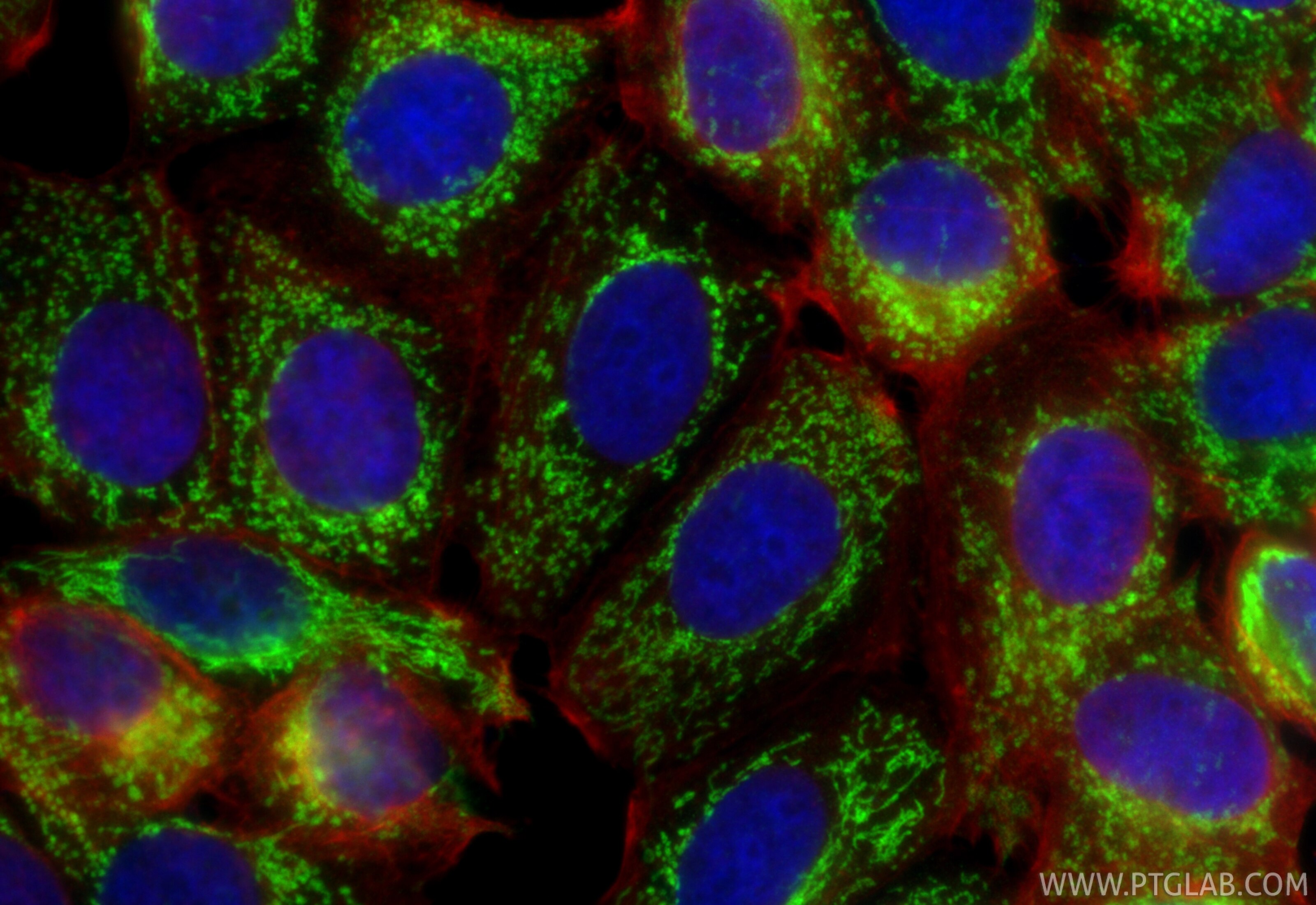 Immunofluorescence (IF) / fluorescent staining of MCF-7 cells using NDUFA4L2 Monoclonal antibody (66050-1-Ig)
