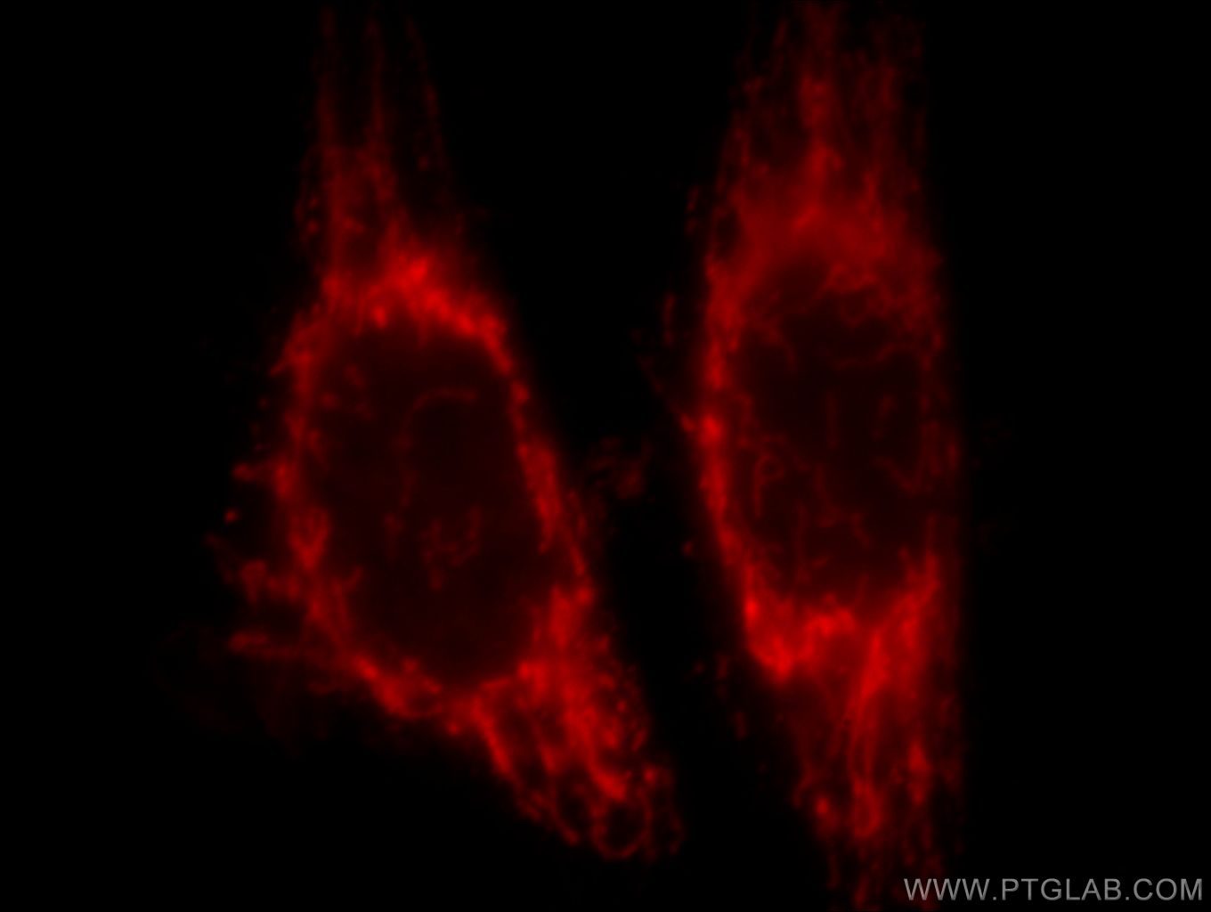 Immunofluorescence (IF) / fluorescent staining of HeLa cells using NDUFA4L2 Monoclonal antibody (66050-1-Ig)