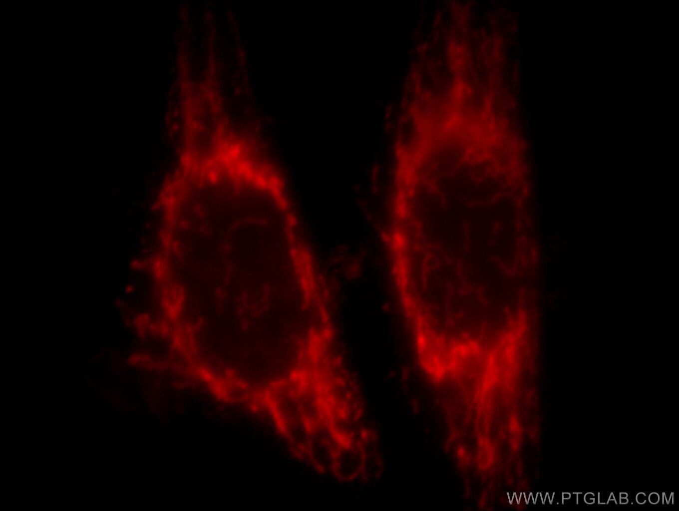 IF Staining of HeLa using 66050-1-Ig