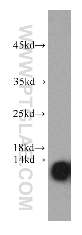 WB analysis of HeLa using 66050-1-Ig