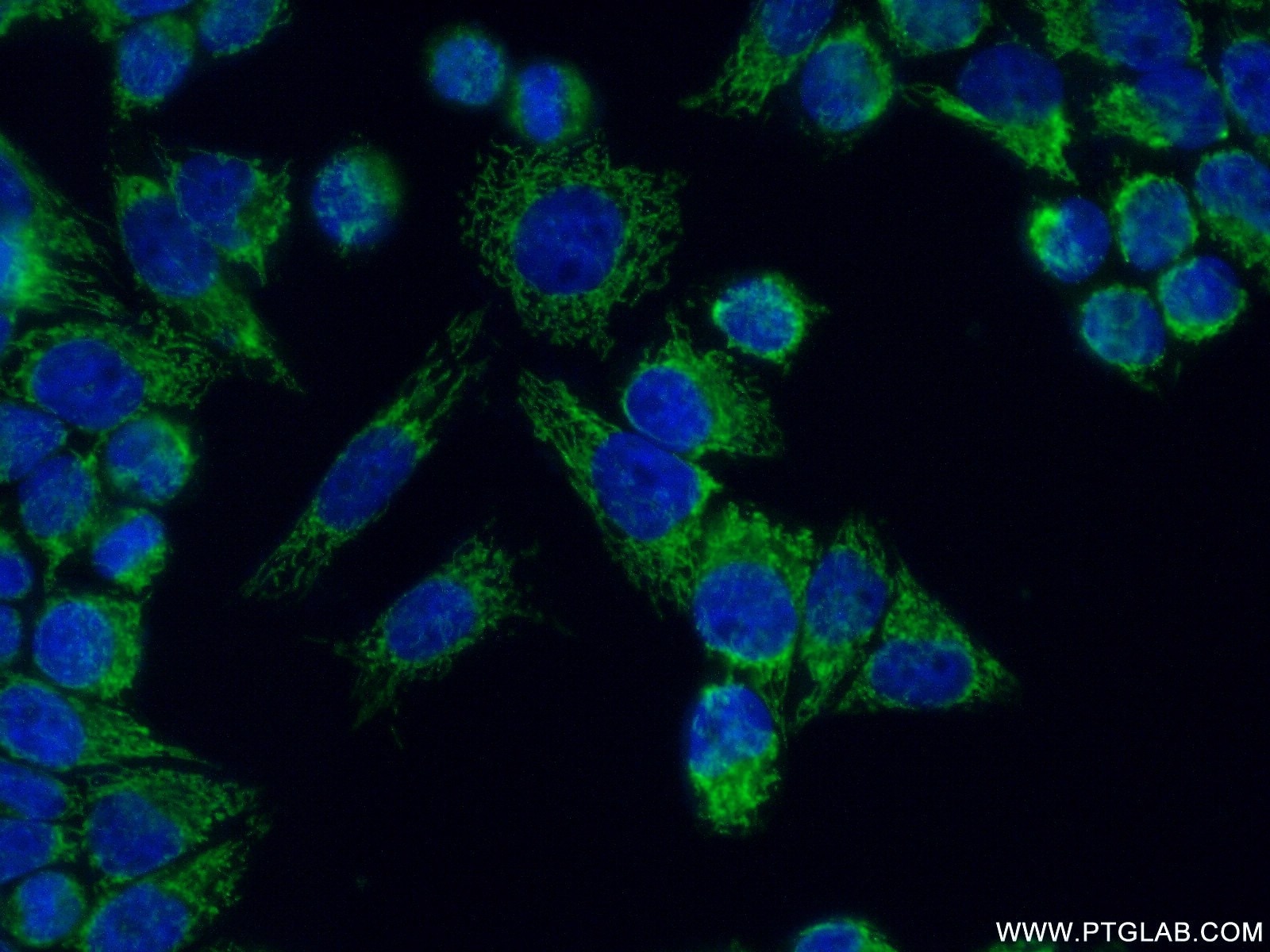 Immunofluorescence (IF) / fluorescent staining of HeLa cells using NDUFA5 Polyclonal antibody (16640-1-AP)