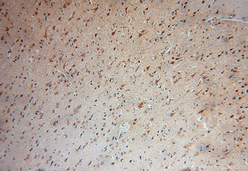 Immunohistochemistry (IHC) staining of human brain tissue using NDUFA5 Polyclonal antibody (16640-1-AP)