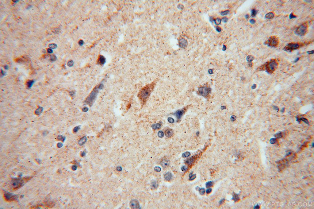 Immunohistochemistry (IHC) staining of human brain tissue using NDUFA5 Polyclonal antibody (16640-1-AP)