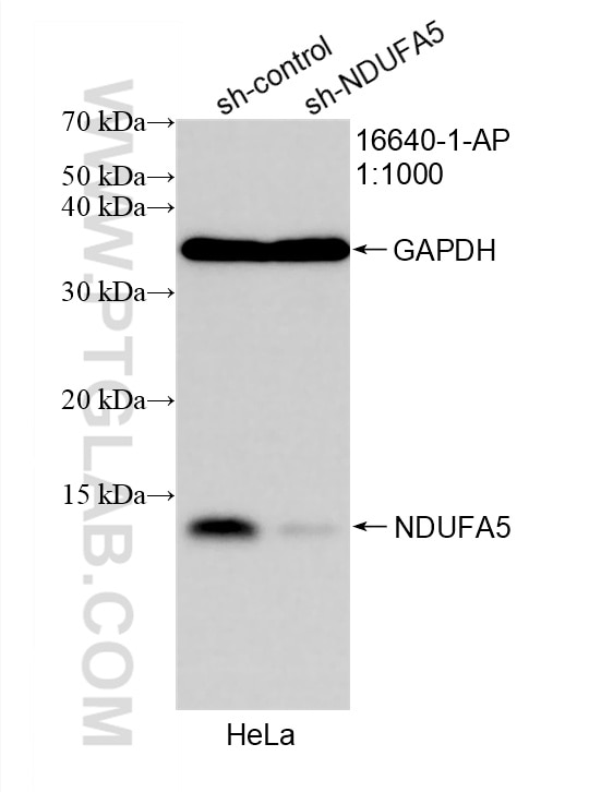Western Blot (WB) analysis of HeLa cells using NDUFA5 Polyclonal antibody (16640-1-AP)