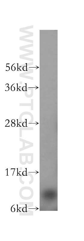 Western Blot (WB) analysis of HeLa cells using NDUFA5 Polyclonal antibody (16640-1-AP)