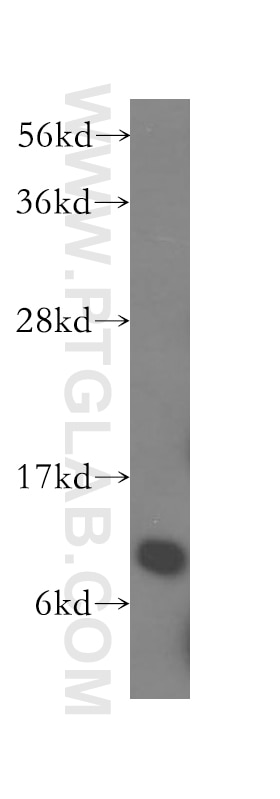 Western Blot (WB) analysis of human brain tissue using NDUFA5 Polyclonal antibody (16640-1-AP)