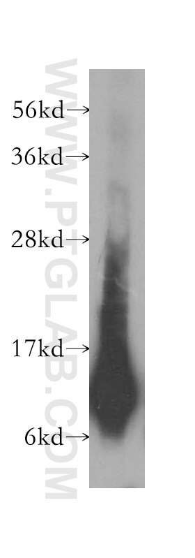 Western Blot (WB) analysis of human heart tissue using NDUFA5 Polyclonal antibody (16640-1-AP)