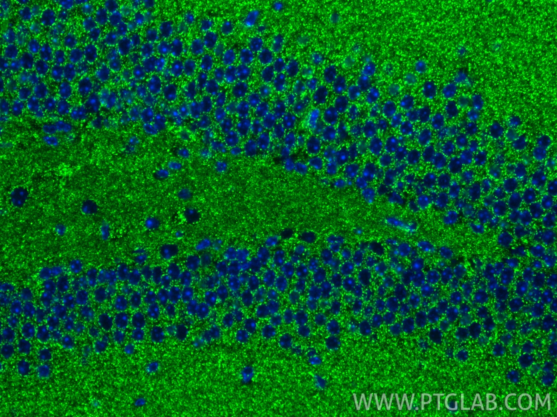 Immunofluorescence (IF) / fluorescent staining of mouse brain tissue using NDUFA5 Recombinant monoclonal antibody (85187-1-RR)