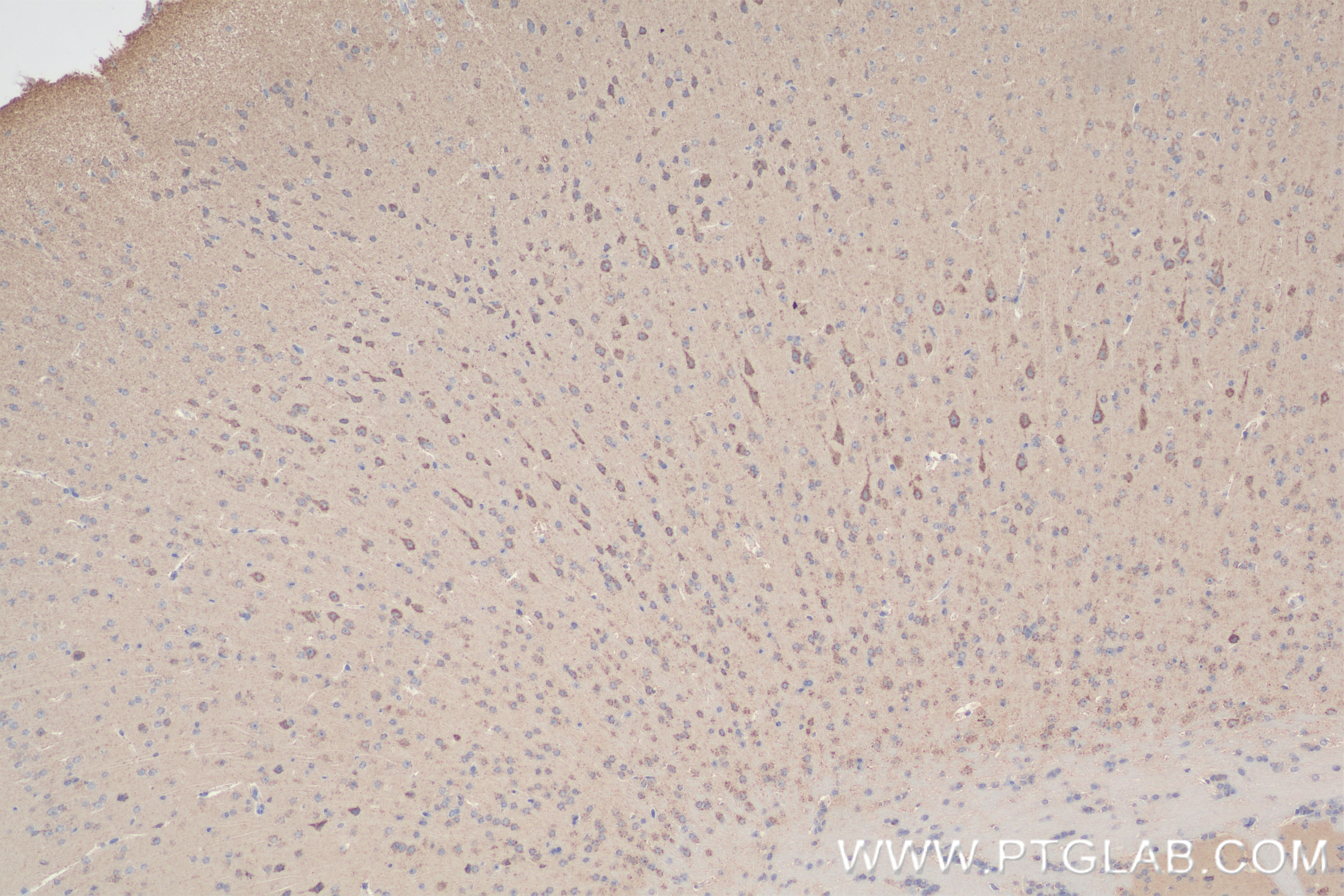 Immunohistochemistry (IHC) staining of mouse brain tissue using NDUFA5 Recombinant antibody (85187-1-RR)