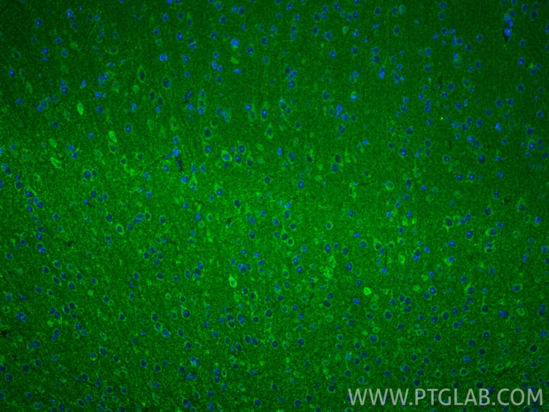 Immunofluorescence (IF) / fluorescent staining of mouse brain tissue using NDUFA6 Polyclonal antibody (15445-1-AP)