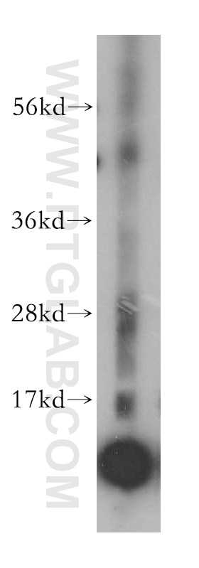 Western Blot (WB) analysis of human heart tissue using NDUFA6 Polyclonal antibody (15445-1-AP)