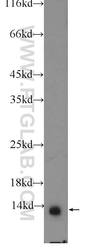 Western Blot (WB) analysis of mouse heart tissue using NDUFA7 Polyclonal antibody (15300-1-AP)