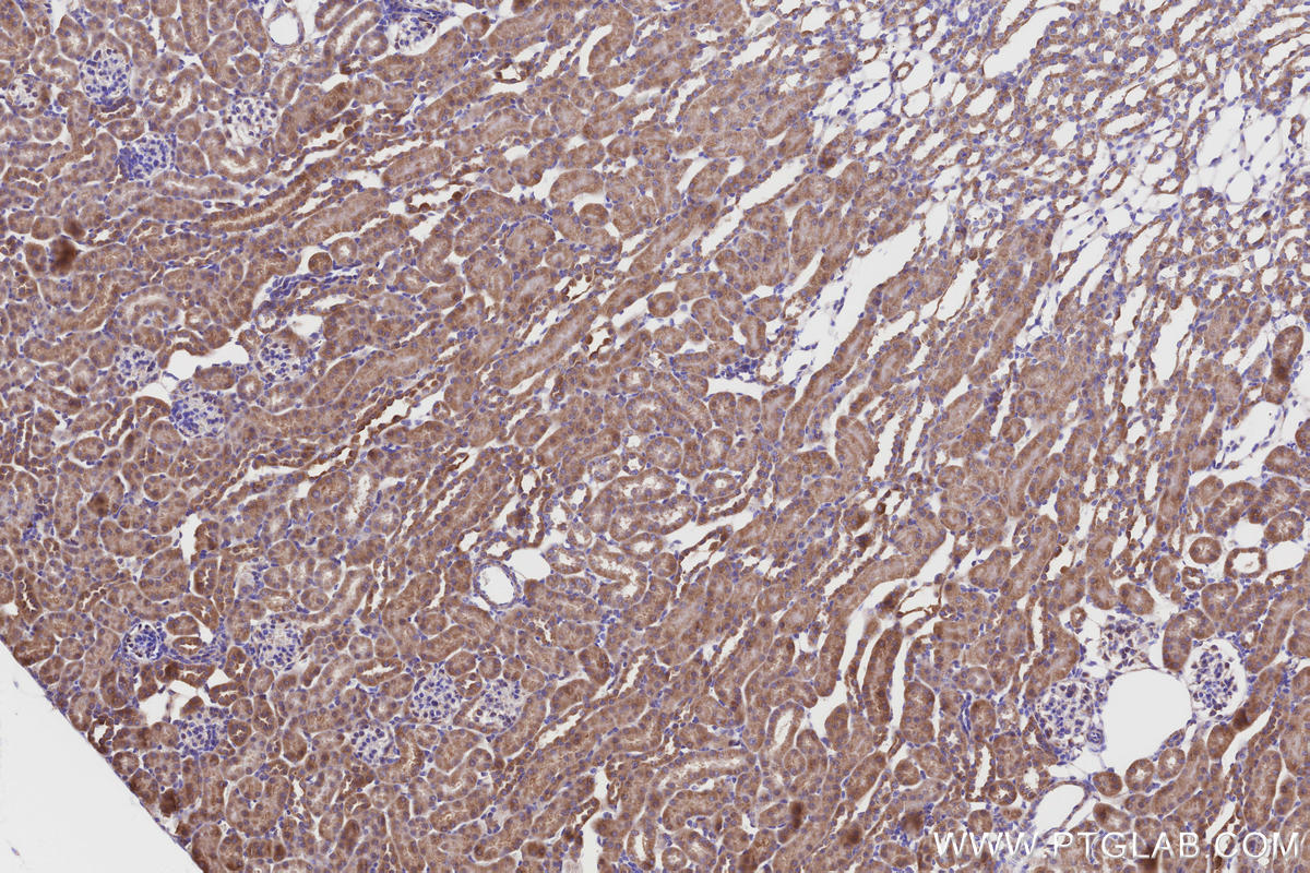 Immunohistochemistry (IHC) staining of mouse kidney tissue using NDUFA8 Polyclonal antibody (15064-1-AP)